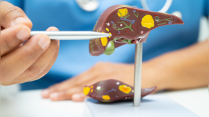Is Your Liver at Risk? Unpacking the Dangers of Alcoholic vs. Non-Alcoholic Fatty Liver Disease