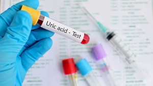 Tiêu đề mới:
Lower Uric Acid Levels in 30 Days: A Guide to Diet and Exercise for Gout Relief